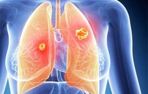 喘息性支气管炎是怎样惹起的 有哪些罕见临床表示