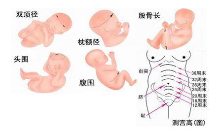 胎儿双顶径是什么意思  胎儿双顶径与孕周标准 - 孕期检查